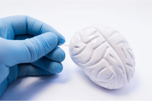 Neurosurgery
